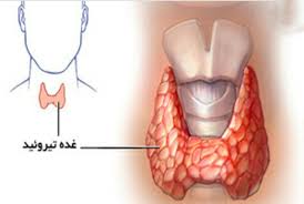 رابطه بیماری تیروئید و کلسترول