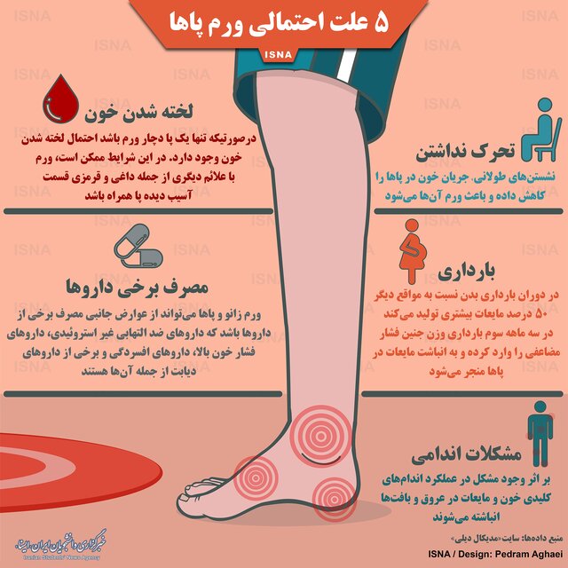 پنج علت احتمالی ورم پا‌ها