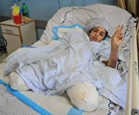رئیس آنروا: روزانه ۱۰ کودک در غزه پای خود را از دست می‌دهند